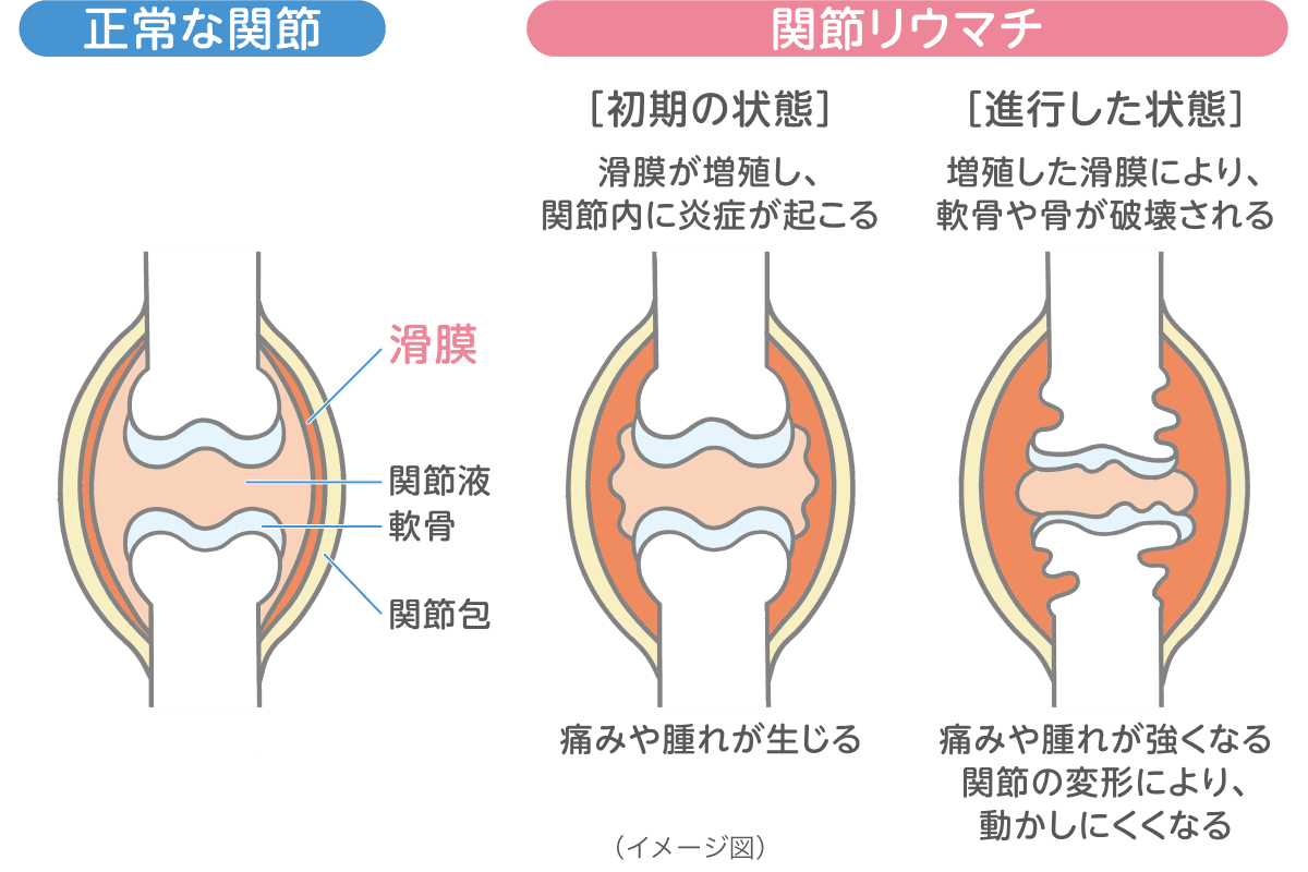 イラスト